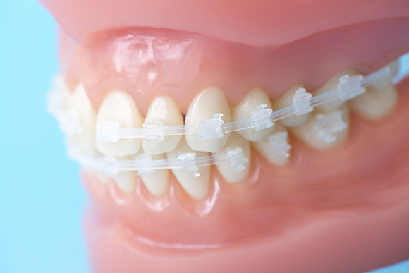 きれいな歯並びや咬み合わせは健康につながります　～矯正歯科治療～